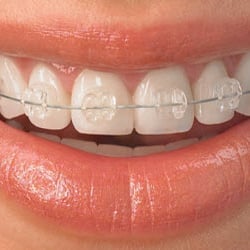 Paterno Orthodontics