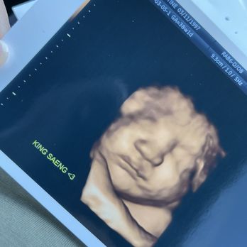 Next Generation Prenatal Imaging - Baby boy at 38 weeks. Love it!!! - Ultrasound Imaging Centers Near Me - Elk Grove, California Next Generation Prenatal Imaging - Baby boy at 38 weeks. Love it!!! - Ultrasound Imaging Centers Near Me - Elk Grove, California
