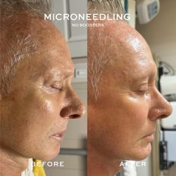 Skin By Women