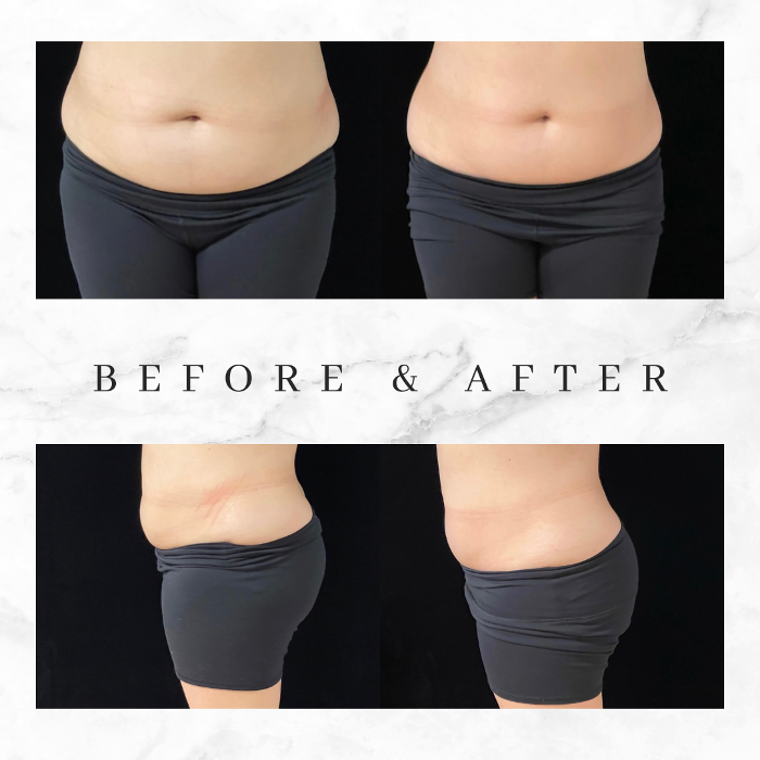 Cloud 17 Med Spa Logo