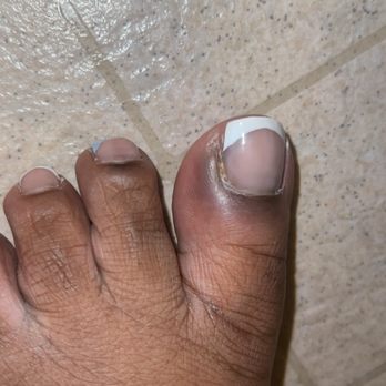 Pro Nail Spa - 2 days after - Nail Salons Near Me - East Stroudsburg, Pennsylvania