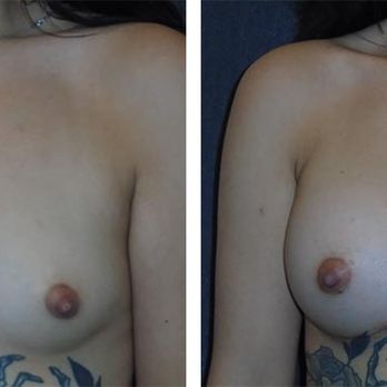 Andres Taleisnik, MD - Cosmetic Surgeons Near Me - Orange, California