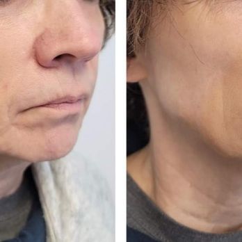 Modern Aesthetics - Weight Loss Centers Near Me - Martinsburg, West Virginia Modern Aesthetics - Weight Loss Centers Near Me - Martinsburg, West Virginia