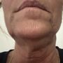 DermaVogue