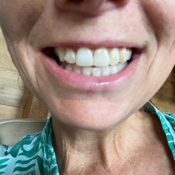 Westcoast Smile Dental - Cosmetic Dentists Near Me - Vancouver, British Columbia Westcoast Smile Dental - Cosmetic Dentists Near Me - Vancouver, British Columbia