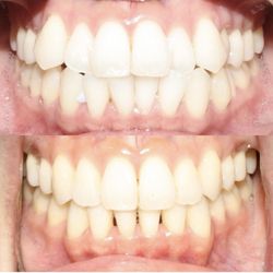 Upland Dental Implant & Orthodontics