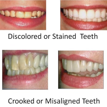 Dr Smile - Discolored and Crooked Teeth - Cosmetic Dentists Near Me - Lomita, California Dr Smile - Discolored and Crooked Teeth - Cosmetic Dentists Near Me - Lomita, California