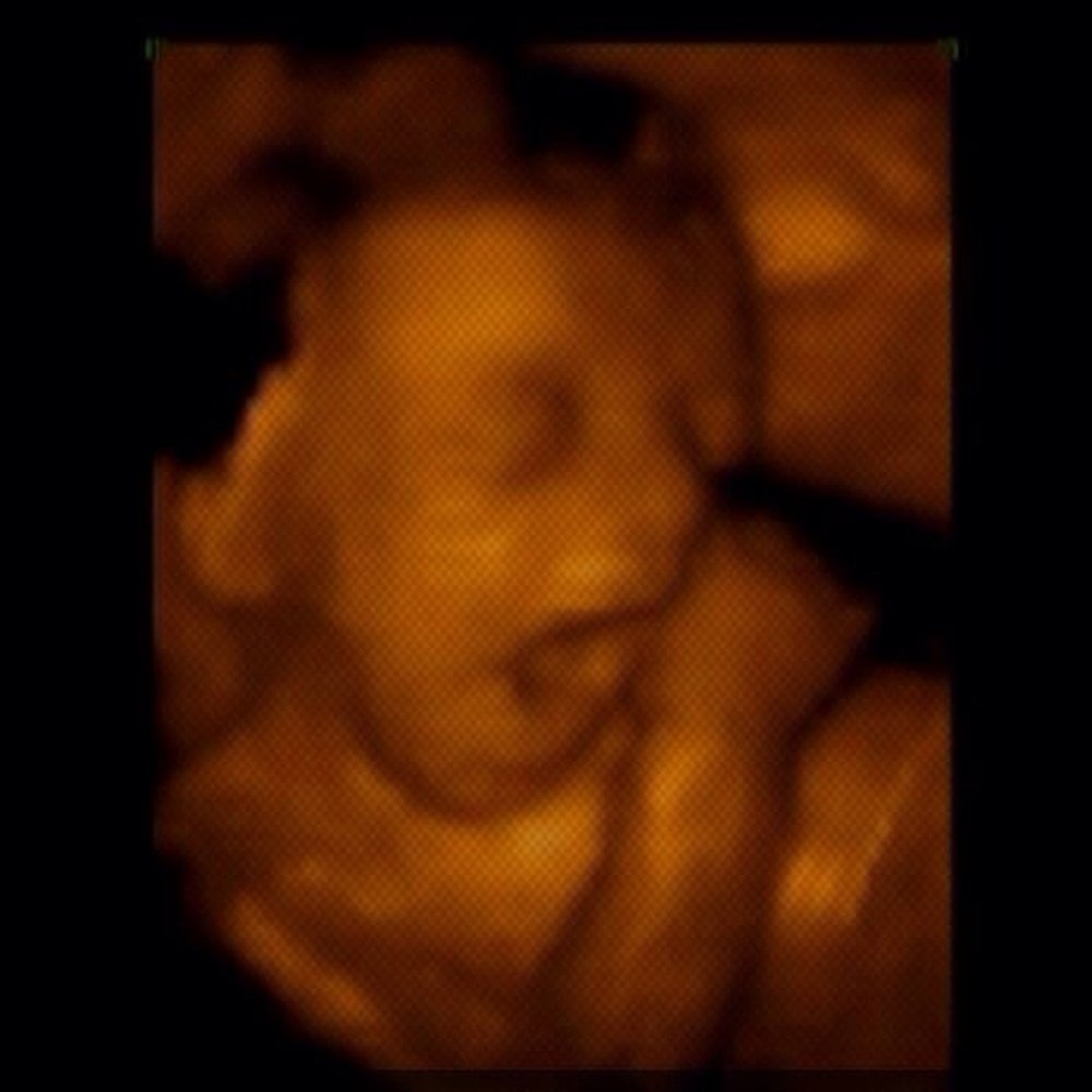 Miracle View 3D/4D Ultrasound - Obstetricians & Gynecologists Near Me - Phoenix, Arizona Miracle View 3D/4D Ultrasound - Obstetricians & Gynecologists Near Me - Phoenix, Arizona