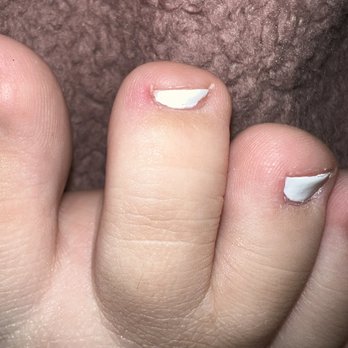 Luxe Nail Bar - Cut toe from being in a rush - Nail Salons Near Me - Tulsa, Oklahoma