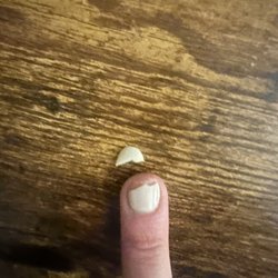 Star Nails & Spa - Broken nail