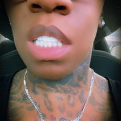 Valparaiso Family Dentistry - My new veneers