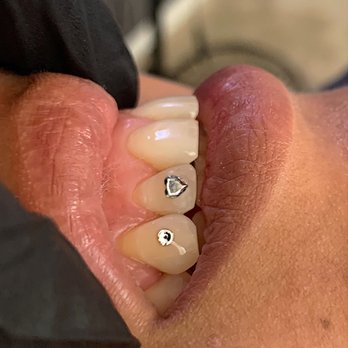 ToothGems by VELA - Cosmetic Dentists Near Me ToothGems by VELA - Cosmetic Dentists Near Me