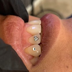 ToothGems by VELA