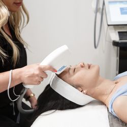 U Med Spa - BBL Photofacial