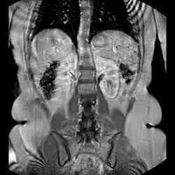 MRI Lincoln Imaging Center - Mri of the abdomen