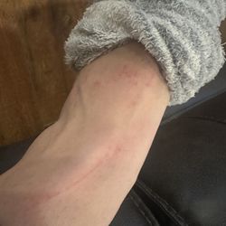 Orchid Nails & Spa - This is my foot the morning after my pedicure.