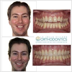 La Jolla Village Orthodontics