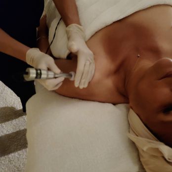 KinetixCa - Micro Channeling - Estheticians Near Me - Huntington Beach, California KinetixCa - Micro Channeling - Estheticians Near Me - Huntington Beach, California