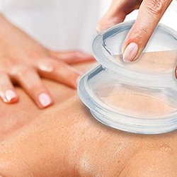 Rama Thai Massage - La Jolla - Cupping Therapy