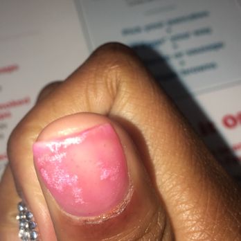 Diva Nails Spa - Got cut EXTREMELY bad here! - Nail Salons Near Me - Chicago, Illinois