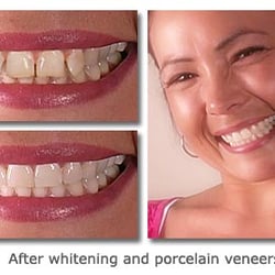David L Evans, DDS - Before & After