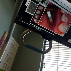 Fox Lake Dental Care - Teeth