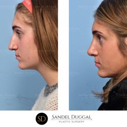 Sandel Duggal Center for Plastic Surgery and Medspa