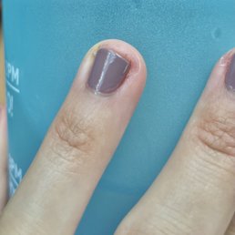 Uneven coat from my initial visit