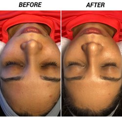Petra Skin Care & Waxing Boutique - Before & After