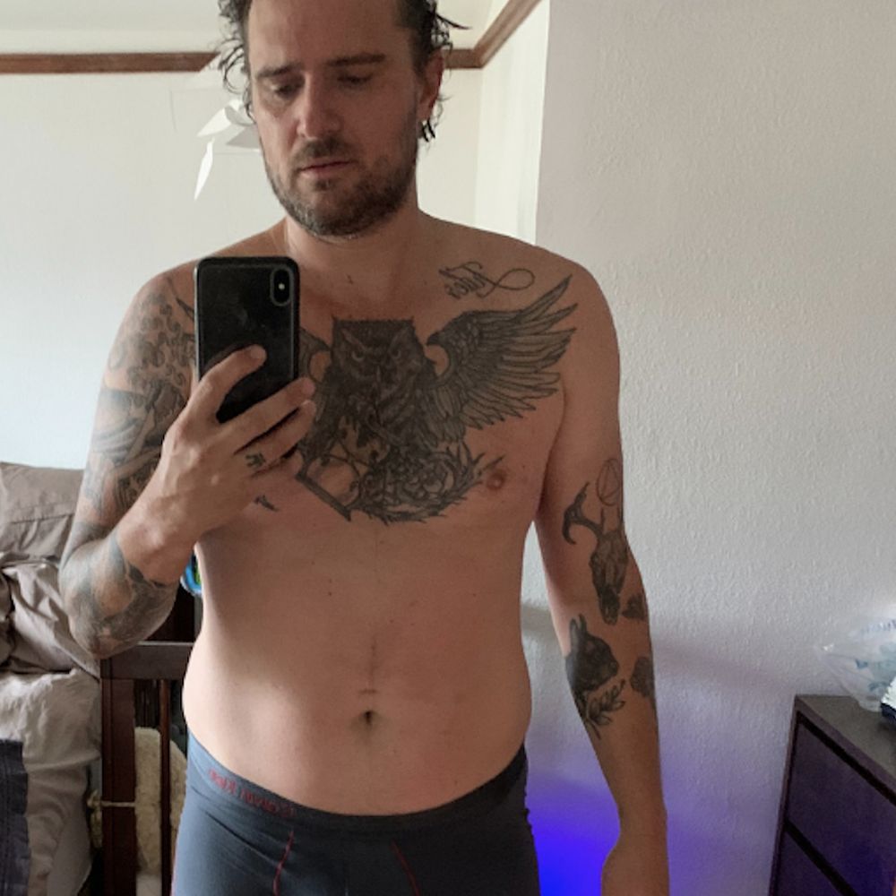 Thrive Men's Clinic - 2 months onto training.
June 2020 - Hair Loss Centers Near Me - Tarzana, California Thrive Men's Clinic - 2 months onto training.
June 2020 - Hair Loss Centers Near Me - Tarzana, California