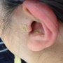 Yang's Acupuncture and Herbs