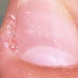 This is what I saw after I ripped off my acrylic nail