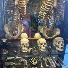 Bones