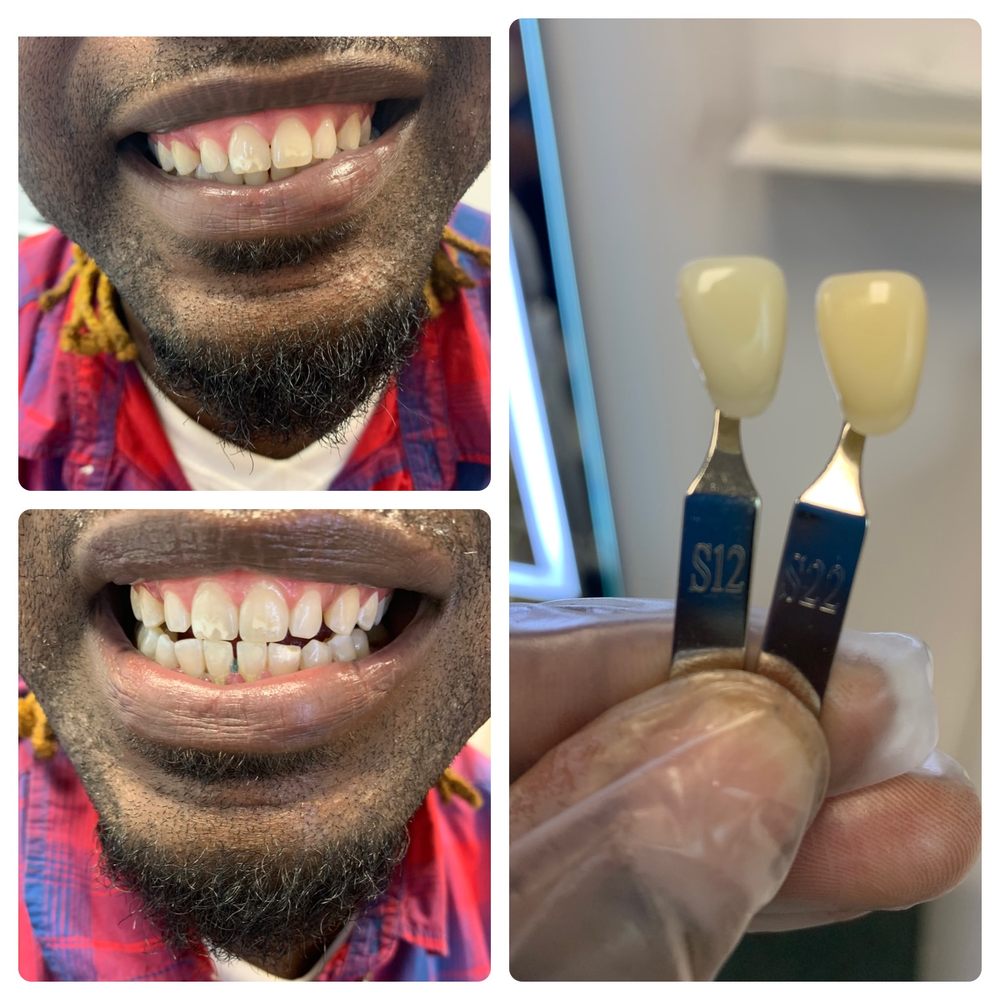 Davine Smiles Teeth Whitening Logo