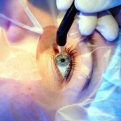 Northville Vision Clinic - Lasik Surgery