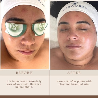 The Dermaplaning Facial - Designed to remove peach fuzz and dead cells for extra smooth skin. this facial allows for deeper product absorption and gives you an immediate glow. double cleanse| steamed enzyme exfoliation dermaplane | extractions | facial massage custom hydro jelly masque | moisturize| high frequency