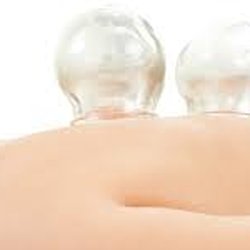 Spring Wellness - Cupping can be added to any massage service.