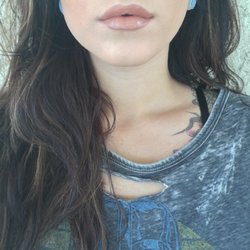 Bella Aesthetics - I Just got 1/2 syringe of juvederm 3 days ago! I was really nervous, and have never had any fillers of any sort before!