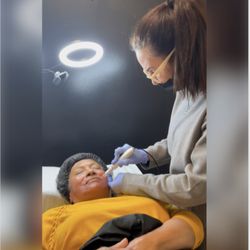 Reveal A Youthful You - Microneedling