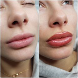 The Art of Lip Blushing - Before & After lipblushing.
IG: @rosetintedstudio