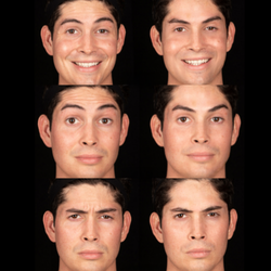 Mara's Med Spa-Uptown - Achieve a relaxed, wrinkle-free look with Botox, tailored for men seeking a natural, confident appearance.