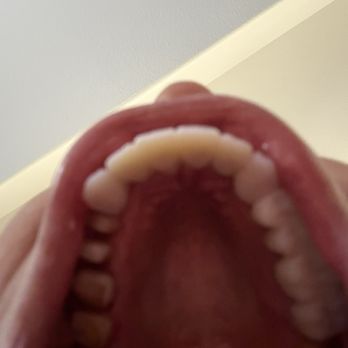 Desert Breeze Dental - Infection - General Dentistry Near Me - Las Vegas, Nevada Desert Breeze Dental - Infection - General Dentistry Near Me - Las Vegas, Nevada