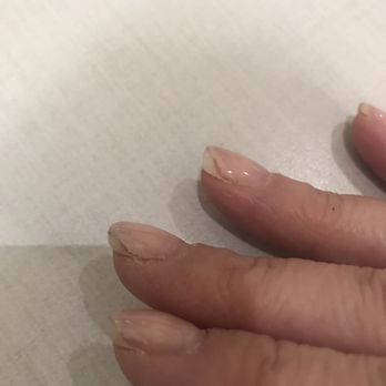 Arrowhead Mall Nail & Spa - Shellac nails chipping after only 6 days - Nail Salons Near Me - Glendale, Arizona