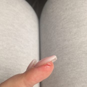 Sophie's Nail Spa - Scrape/cut that occurred after she filed my nails with an emery board - Nail Salons Near Me - San Anselmo, California Sophie's Nail Spa - Scrape/cut that occurred after she filed my nails with an emery board - Nail Salons Near Me - San Anselmo, California