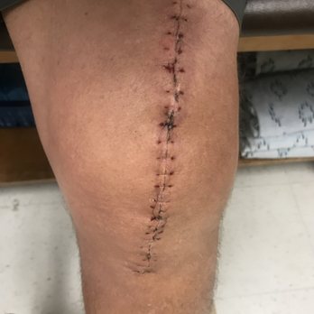 Bryan Thomas O, MD - After a week to three weeks - Orthopedists Near Me - West Covina, California Bryan Thomas O, MD - After a week to three weeks - Orthopedists Near Me - West Covina, California