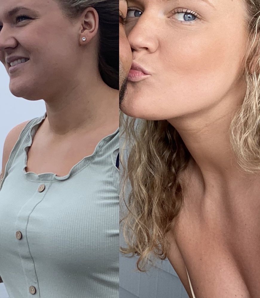 Richard Zienowicz / bodybyZ Plastic Surgery