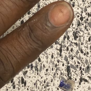 Top Nails - The nail that was burning under left a bruise under my nail - Nail Salons Near Me - Fort Worth, Texas