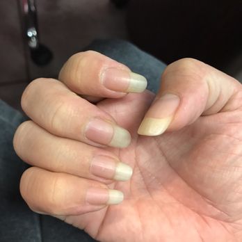 Blooming Nails Spa - "Before." - Nail Salons Near Me - San Pablo, California