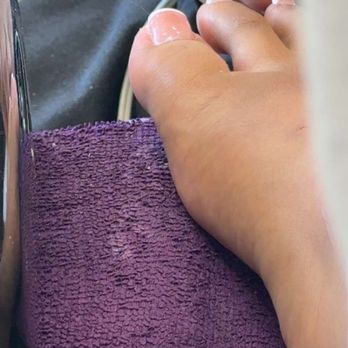 La Bella Spa Salon - also a cut on the top of my foot - Nail Salons Near Me - Foster City, California