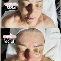 Maya Beauty and Brows - Before and after facial treatment